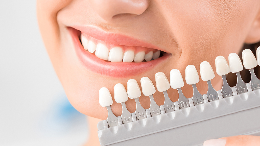 歯科矯正を受ける患者に人気のホワイトニングのイメージ