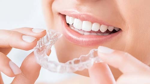 品川で歯列矯正の人気・おすすめのマウスピース矯正のイメージ