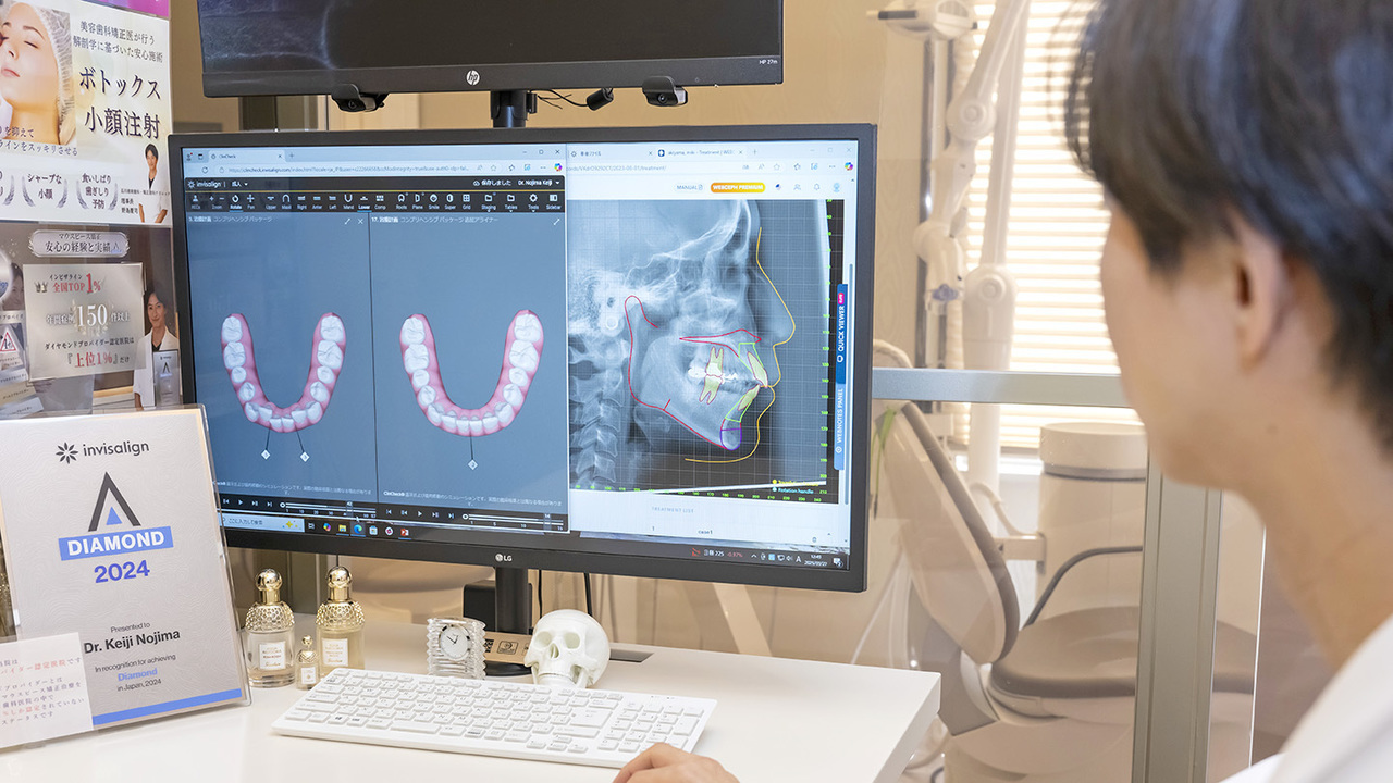 歯列矯正を検討中の方におすすめの3Dシミュレーション
